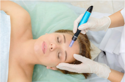 Micro-Needle Facial
